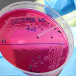 Isolation of a strain belonging to a new Salmonella serovar