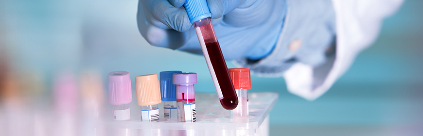 Rabies antibody titration